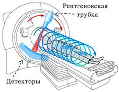 Компьютерный томограф